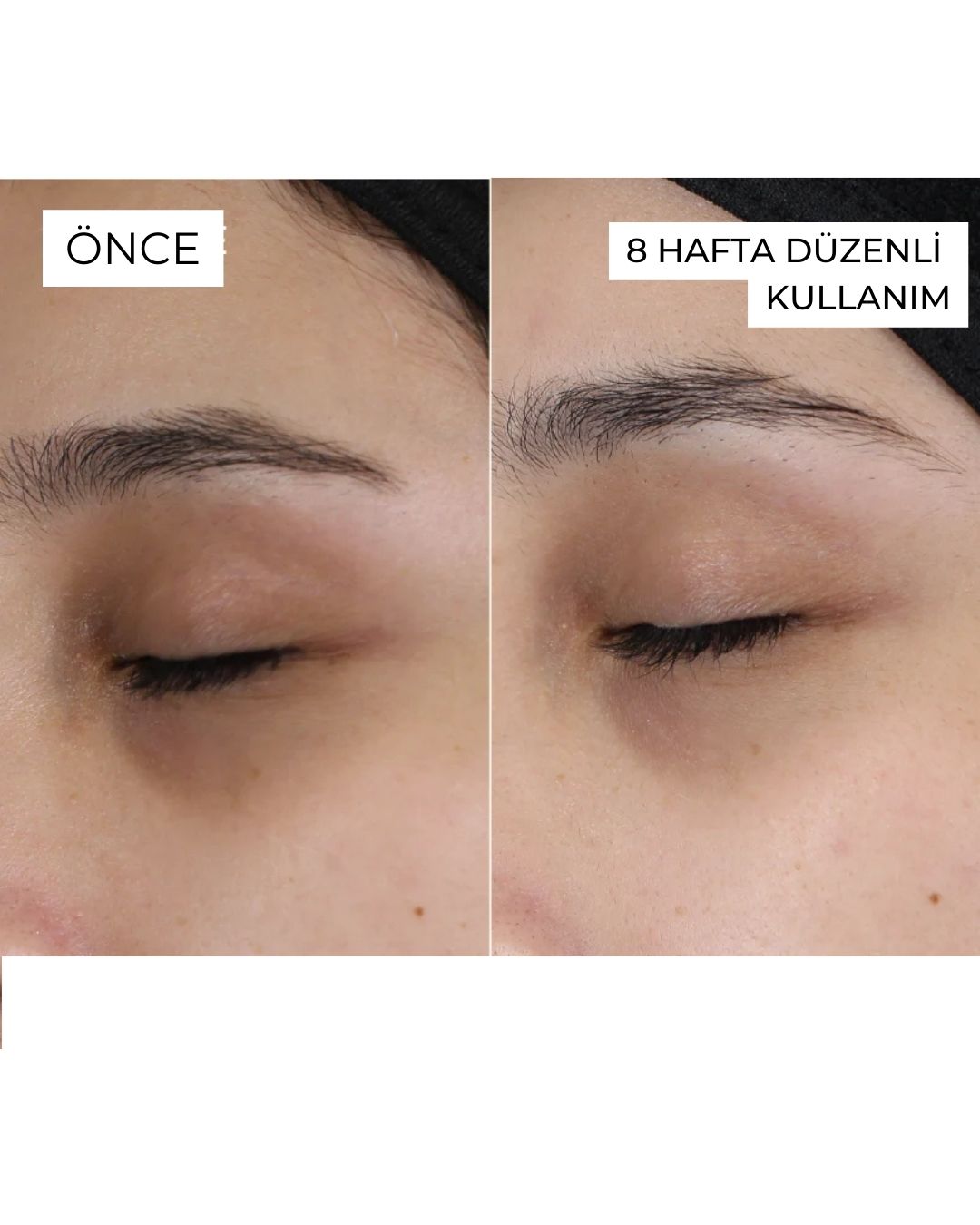 Yaşlanma Karşıtı Botoks Etkili Serum