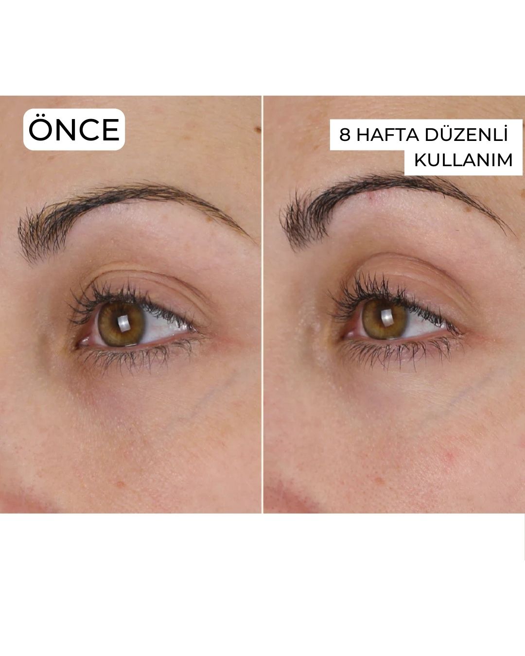 Yaşlanma Karşıtı, Cilt Yenileyici Set