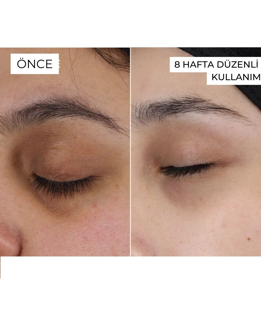 Yaşlanma Karşıtı, Cilt Yenileyici Set